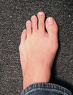 toe climbing shoes